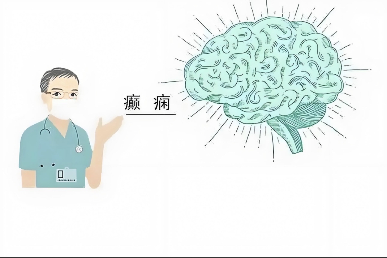 癫痫病是一种脑部异常放电导致的慢性疾病,主要