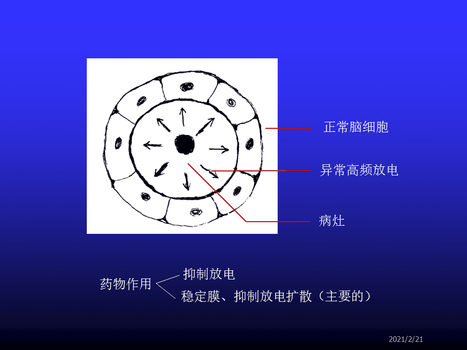 癫痫药与抗惊厥药 作用机制、分类及应用综述