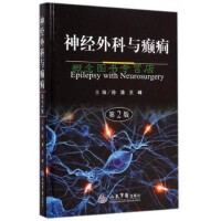 神经外科与癫痫 从诊断到手术治疗的全面解析